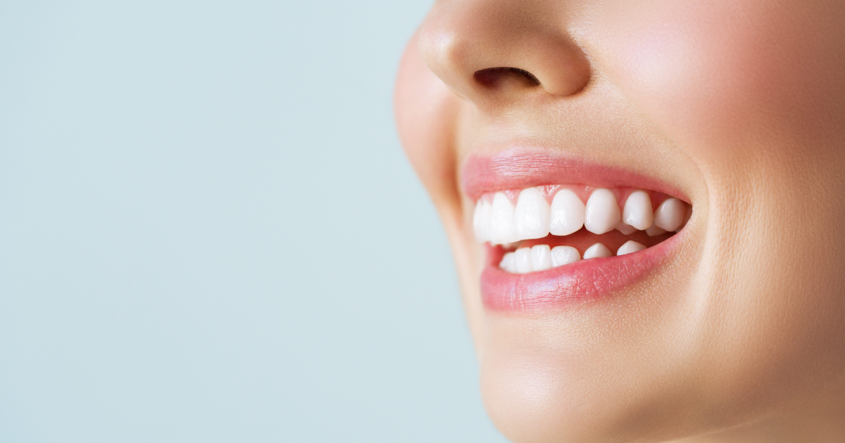 Bright smile after Crown Lengthening treatment in Mount Pleasant, SC