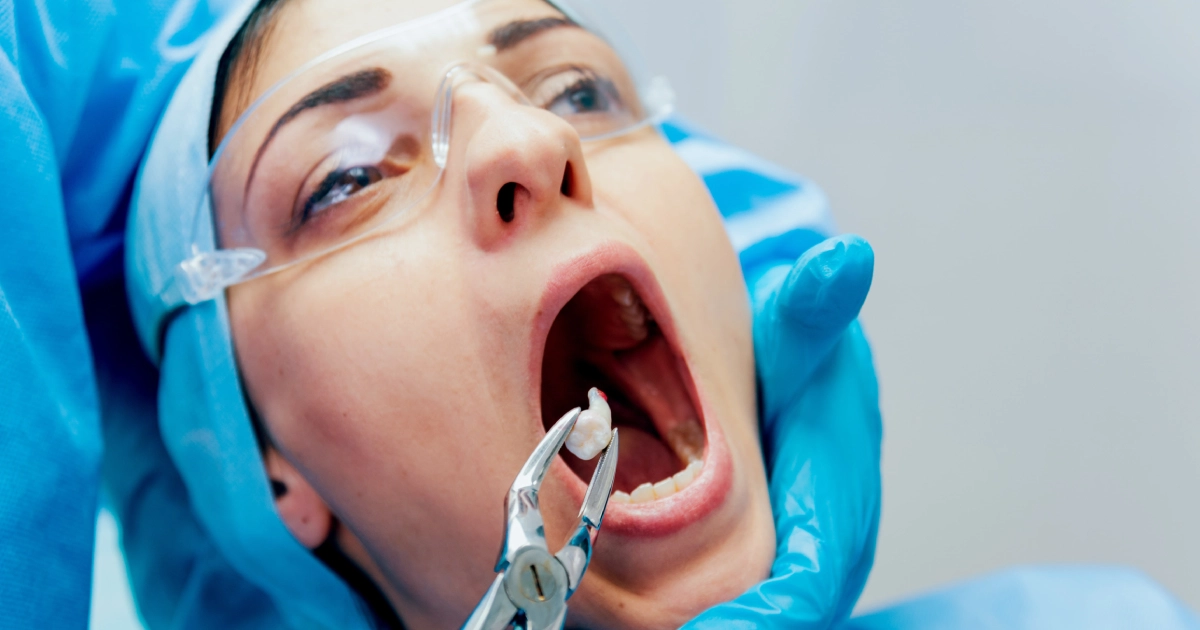 A dental professional performing a painless tooth extraction on a patient in Mount Pleasant, SC