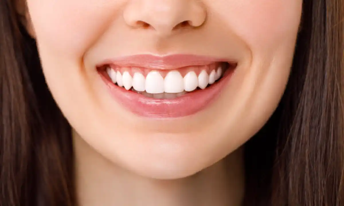 Crown Lengthening in Mount Pleasant, SC