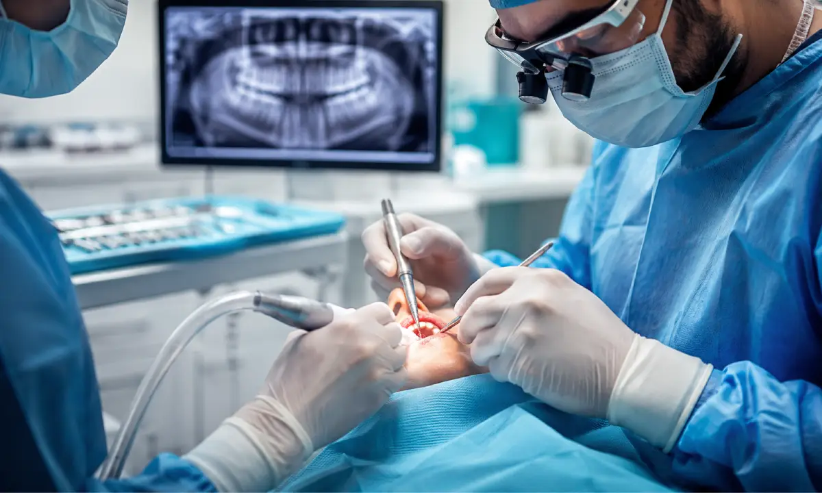 Cross-section diagram showing periodontal pocket reduction and bone reshaping during osseous surgery.